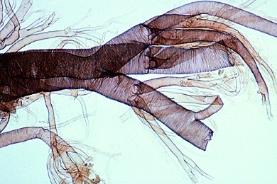 Mikropräparat - Tracheen vom Insekt. Verzweigte Atemröhren