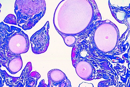 Mikropräparat - Gallus, Huhn, Eierstock quer, Entwicklung der Eier