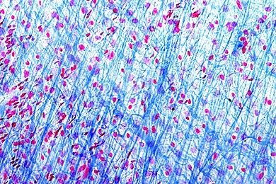 Mikropräparat - Fibrilläres Bindegewebe aus dem Mesenterium, total