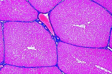 Mikropräparat - Leber, Schwein, quer, Leberläppchen, interlobuläres Bindegewebe