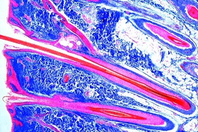 Mikropräparat - Kopfhaut vom Menschen, Haarwurzeln längs