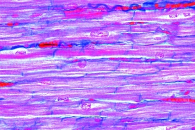Mikropräparat - Herzmuskulatur der Katze, längs