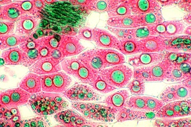 Mikropräparat - Fettes Öl, Endosperm von Corylus, Haselnuß, Fettfärbung