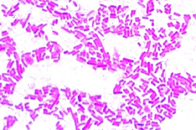 Mikropräparat -  Salmonella enteritidis, Wurstvergiftung, Ausstrich