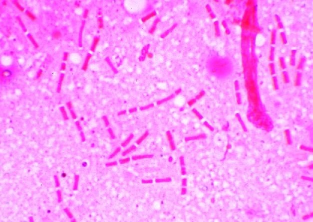 Mikropräparat - Bacillus anthracis, Milzbranderreger, Ausstrich von Kultur