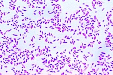 Mikropräparat - Pasteurella (Yersinia) pestis, Pesterreger, Ausstrich *