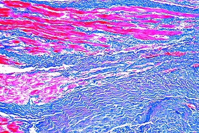 Mikropräparat - Herzschwielen