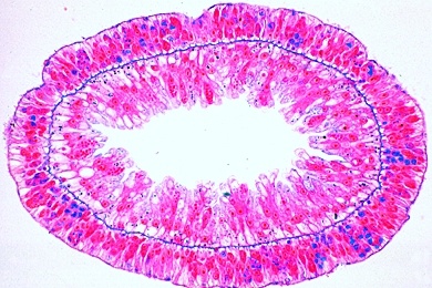 Mikropräparat - Süßwasserpolyp, Hydra, quer, Ectoderm, Entoderm, Nahrungsstoffe