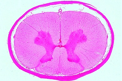 Mikropräparat - Rückenmark vom Säugetier, quer