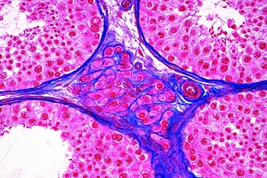 Mikropräparat - Hoden der Maus, quer, Leydigsche Zwischenzellen