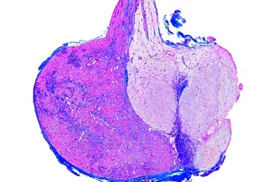 Mikropräparat - Hypophyse, längs, Adeno- und Neurohypophyse