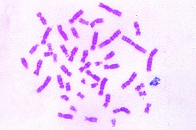 Mikropräparat - Chromosomen des Menschen