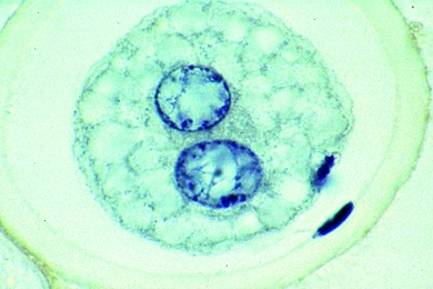 Mikropräparat - Pferdespulwurm, Ascaris, Eier mit Meiose-Stadien