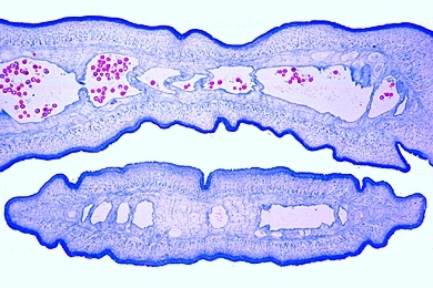 Mikropräparat - Taenia saginata, Bandwurm, Proglottiden (Glieder), quer