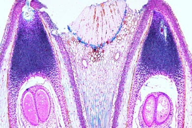 Mikropräparat - Kiefer, Samenanlage mit Archegonien, längs