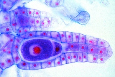 Mikropräparat - Marchantia, Lebermoos, Archegonienträger längs