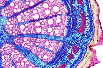 Mikropräparat - Aristolochia, Pfeifenstrauch, mehrjähriger Stamm, quer. Sekundäres Dickenwachstum