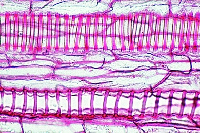 Mikropräparat - Cucurbita, Kürbis, Stamm längs. Gefäßbündel mit Siebröhren, Ring- und Netzgefäßen, Sklerenchymfasern
