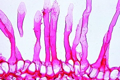 Mikropräparat - Wurzelspitze mit Wurzelhaaren