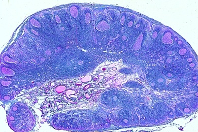 Mikropräparat - Lymphknoten, quer