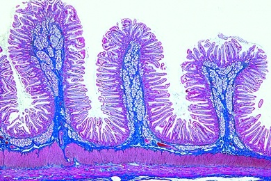 Mikropräparat - Zwölffingerdarm (Duodenum), quer