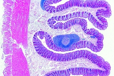 Mikropräparat - Dickdarm (Colon), quer