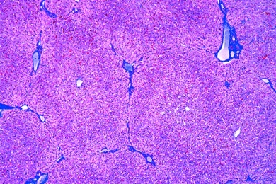 Mikropräparat - Leber, quer