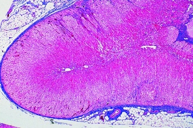 Mikropräparat - Nebenniere (Gl, suprarenalis), quer