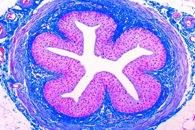 Mikropräparat - Harnleiter (Ureter), quer