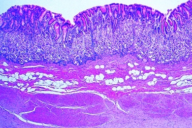 Mikropräparat - Magen, Fundusregion quer