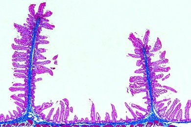 Mikropräparat - Dünndarm (Jejunum), quer