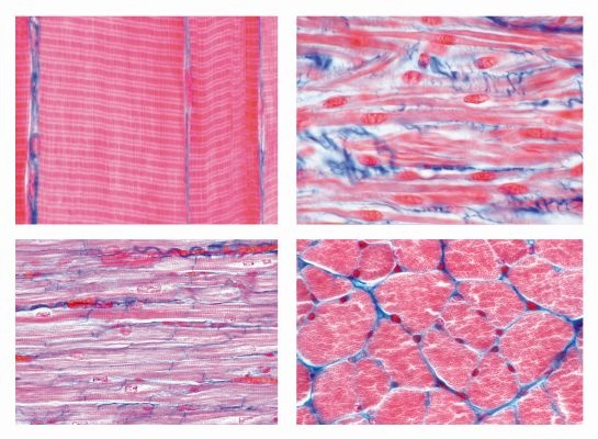 Histologie, Muskelgewebe, 6 Präparate, mit  Begleitheft