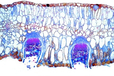 Mikropräparat - Puccinia graminis, Getreiderost, Aezidien und Pyknidien auf Blatt der Berberitze, quer