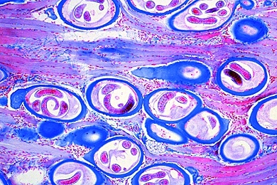 Mikropräparat - Trichinella spiralis, Trichine, eingekapselte Larven im Muskel, Schnitt