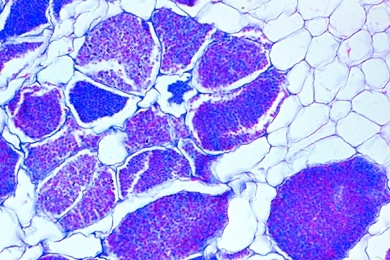 Mikropräparat - Kohlhernie, Plasmodiophora brassicae, mit Sporen, quer