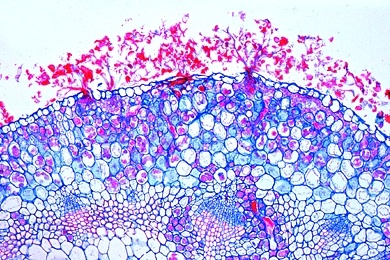 Mikropräparat - Falscher Mehltau der Kreuzblütler, Peronospora parasitica, Wirtsgewebe mit Konidien, quer