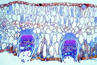 Mikropräparat - Getreiderost, Puccinia graminis, Aezidien oder Pyknidien auf Blatt der Berberitze, quer