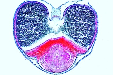 Mikropräparat - Weizenkorn, quer. Schichten der Samenschale. Endosperm