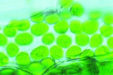 Mikropräparat - Chloroplasten, Blatt der Wasserpest (Elodea), Feinstruktur