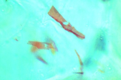 Mikropräparat - Chromoplasten in der Wurzel der Möhre (Daucus carota), quer