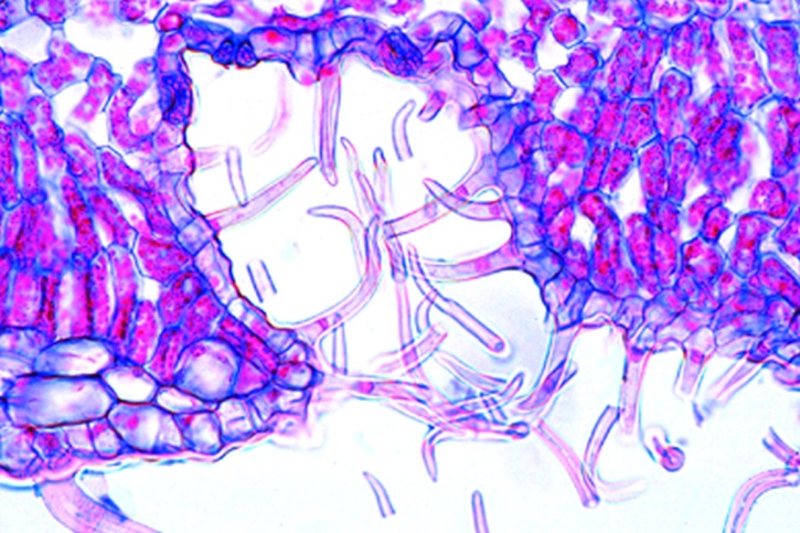 Mikropräparat - Oleander (Nerium), Blatt mit eingesenkten Spaltöffnungen, quer