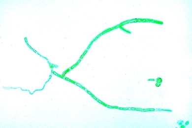 Mikropräparat - Polytrichum, Haarmoos, Vorkeim (Protonema), total, Laubmoose (Musci)