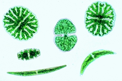 Mikropräparat - Desmidiazeen, Zieralgen, Streupräparat mit vielen Formen