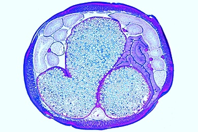 Mikropräparat - Ascaris, Region der weiblichen Gonaden, quer