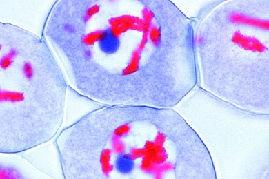 Mikropräparat - Lilie, Diakinese. Spiralisierung und damit Verkürzung der Chromatidentetraden, Ende der Prophasestadien