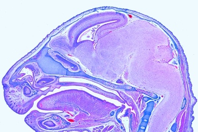Mikropräparat - Embryo vom Schwein, 15 mm, Querschnitt durch die Kopfregion