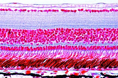 Mikropräparat - Rana, Augenhintergrund mit Retina, quer