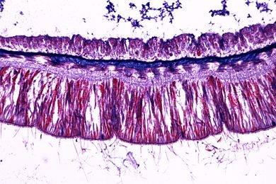 Mikropräparat - Hydra, Längsschnitt durch Körper und Tentakeln