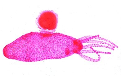 Mikropräparat - Hydra, Totalpräparat mit Ovarien *