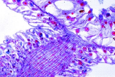 Mikropräparat - Hydra, isolierte Zellen. Darstellung der verschiedenen Zelltypen
